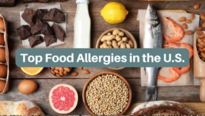 top food allergens in the US
